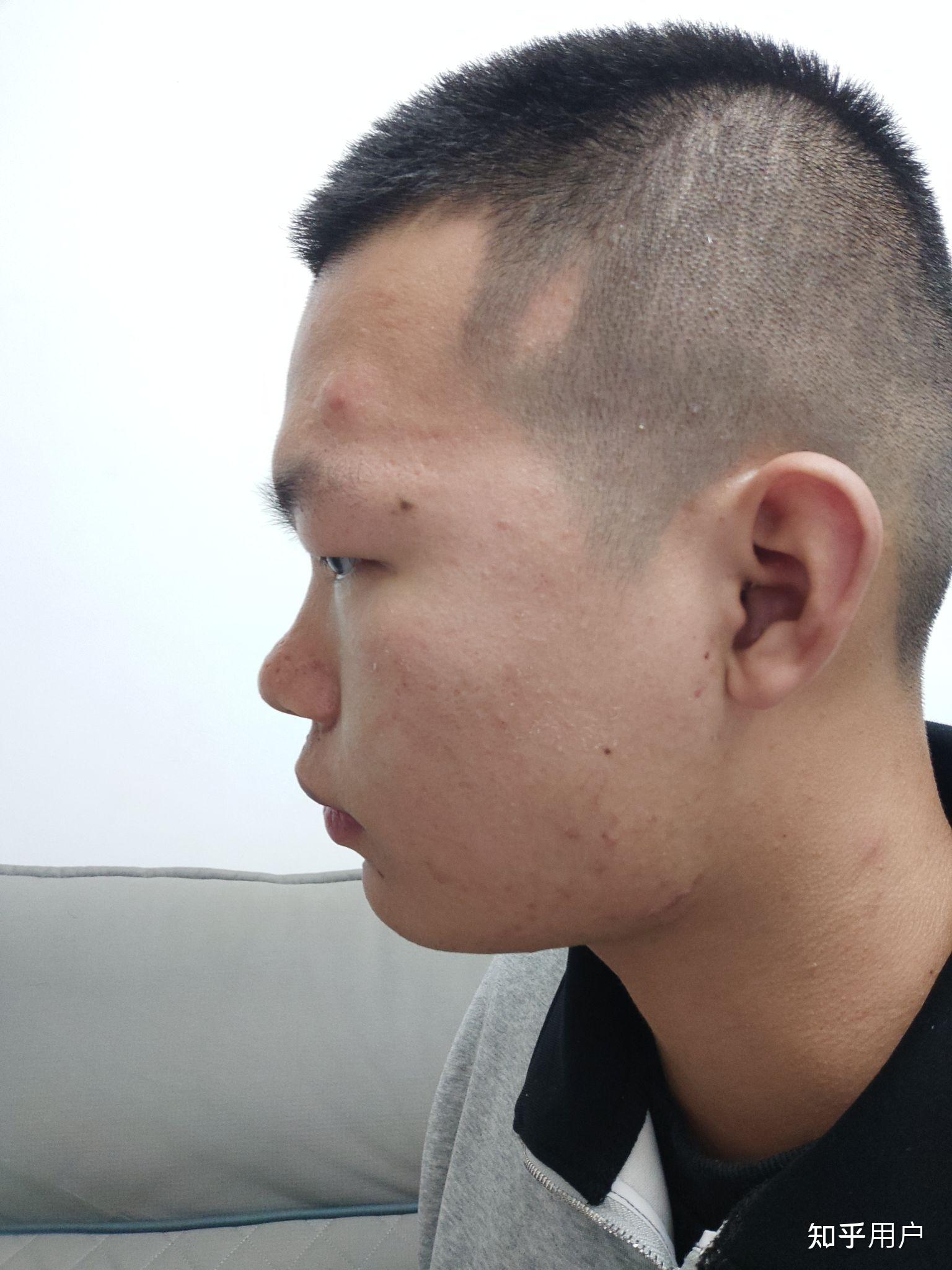 有没有长得丑的男生照片分享一下.我想知道什么样算丑 ? - 知乎