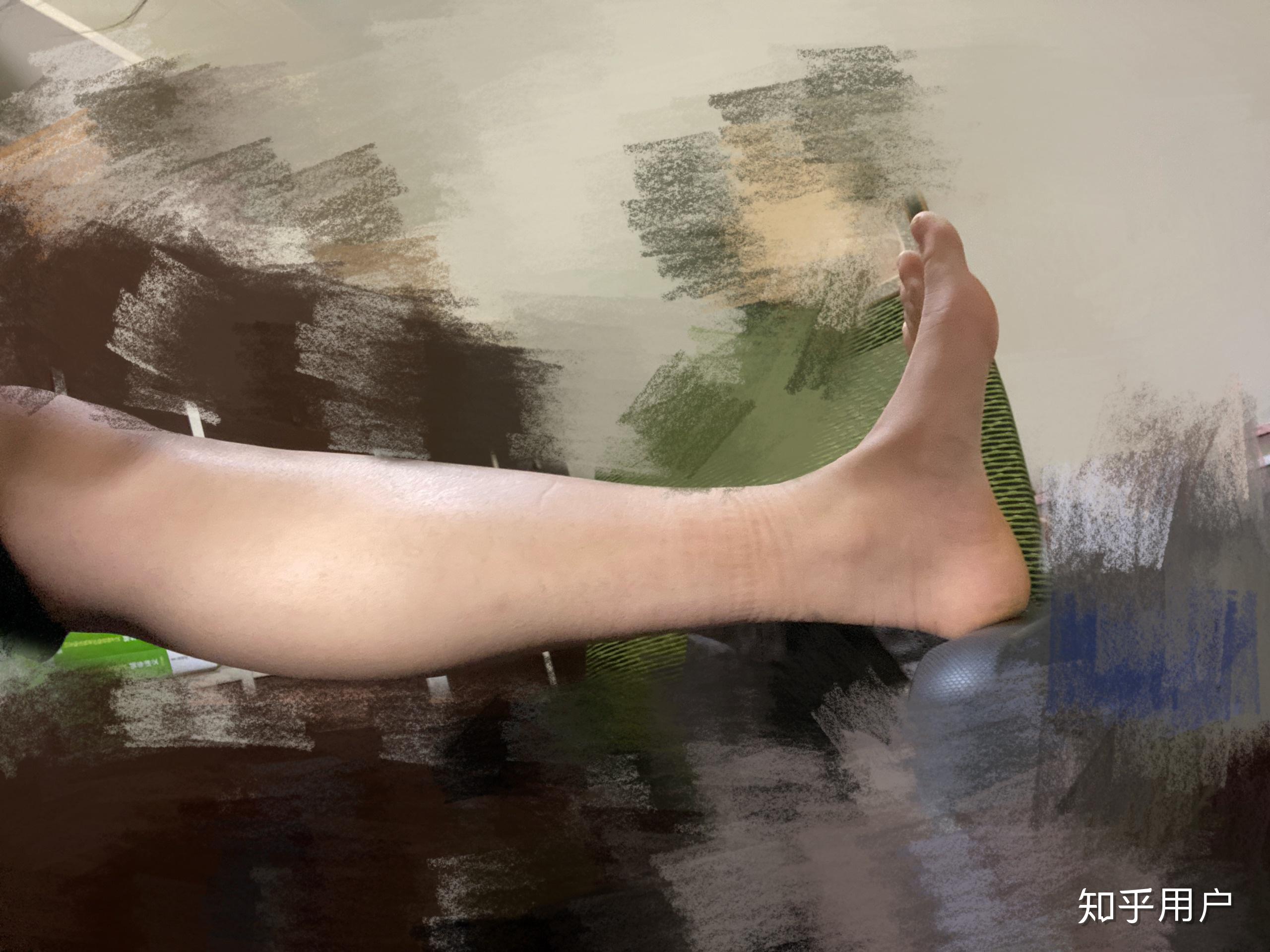 人的跟腱长度与弹跳力之间的关系大不大