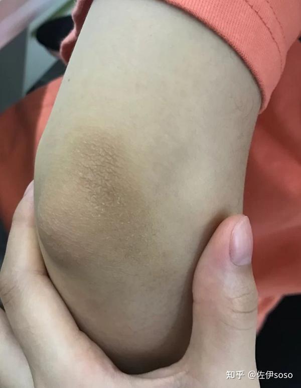 磨砂膏是智商税吗?是不是用搓澡巾也差不多?