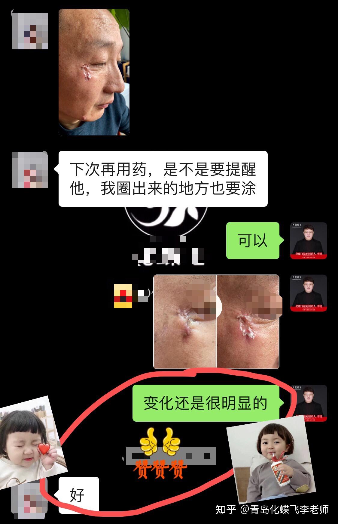 磕伤缝合疤痕 - 知乎