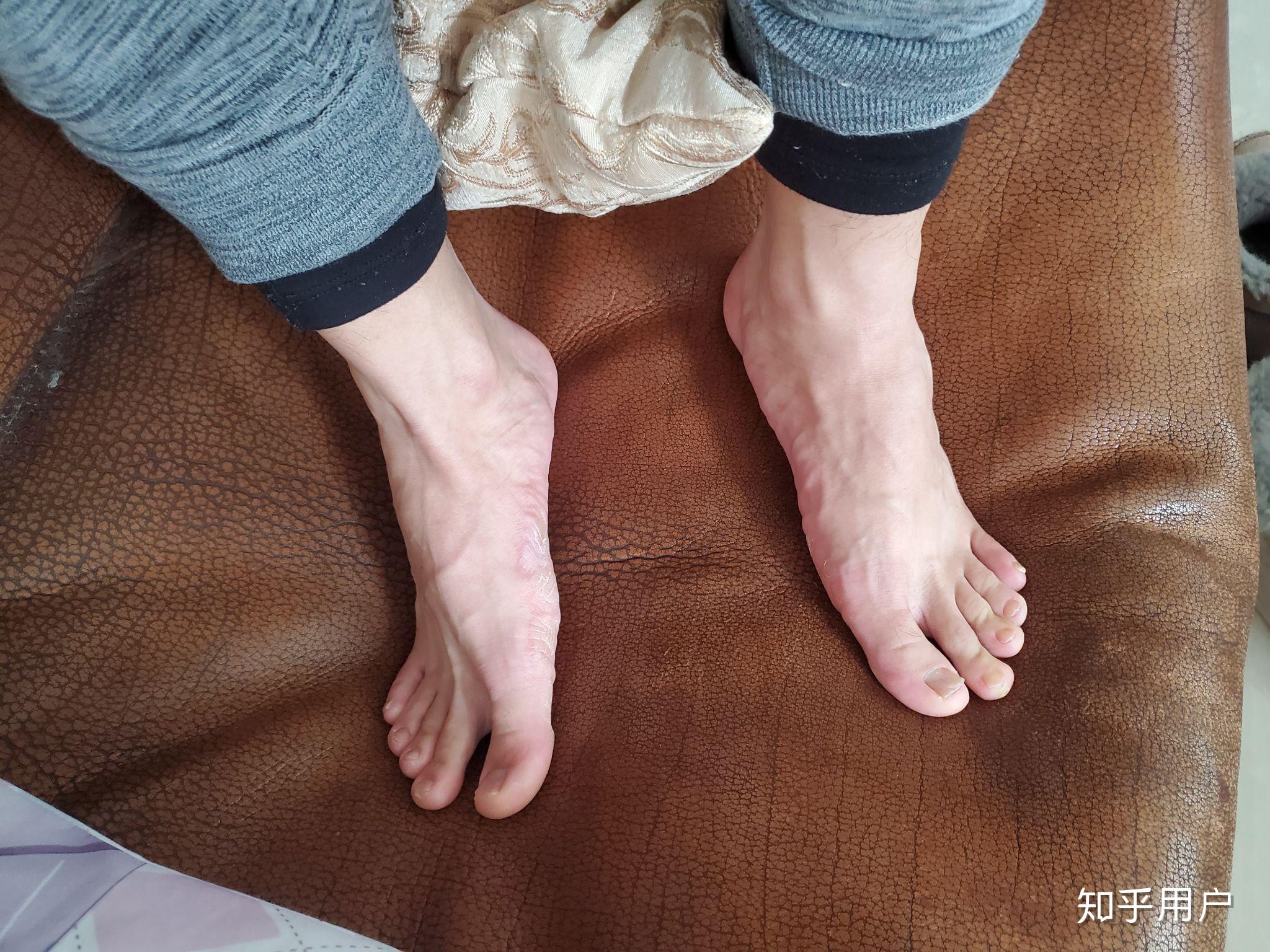 我女生,喜欢被男生用臭脚丫子踩脸是怎么回事?