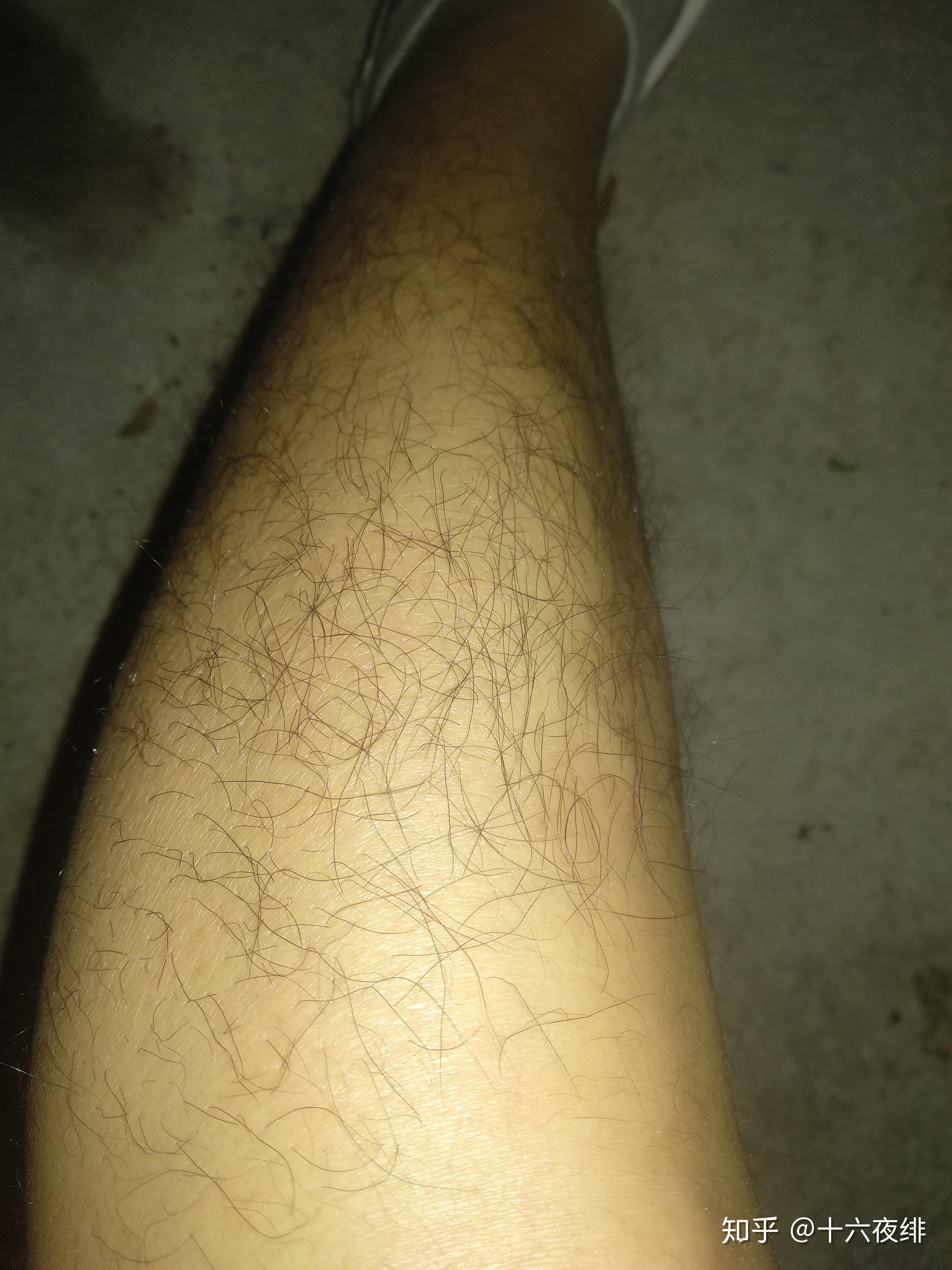 腿毛多太多是怎样的体验