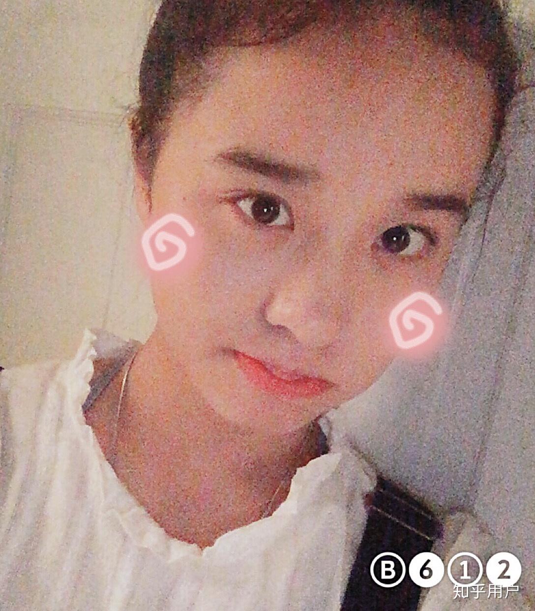 抖音里叫steph的网红动过刀子吗