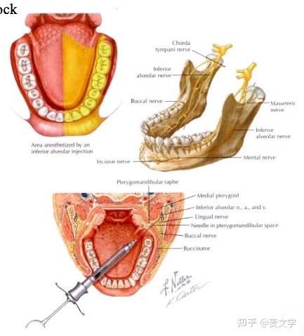 乳牙麻醉方法和图片图片