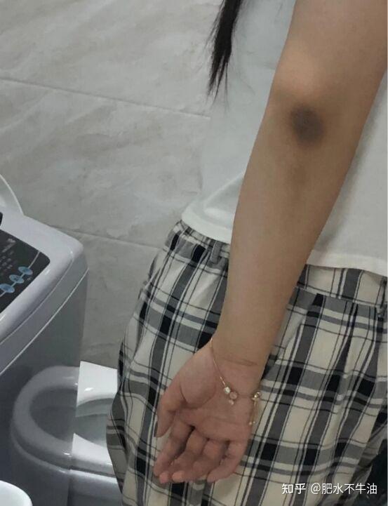 夏天到了怎么防晒和美白