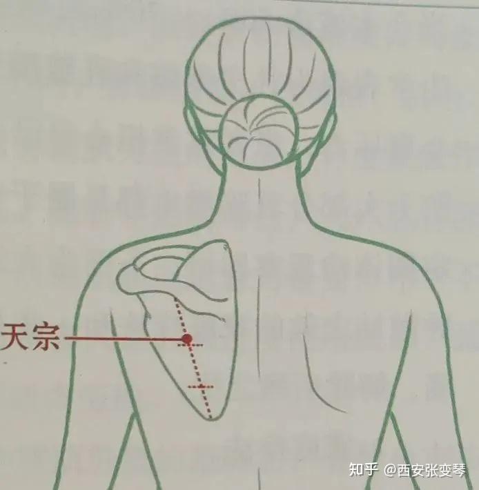 推拿天宗穴治疗呃逆(打嗝) - 知乎