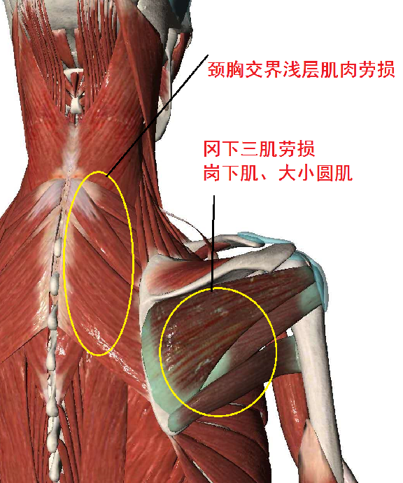 为什么有时候深呼吸会觉得右边锁骨部位疼痛