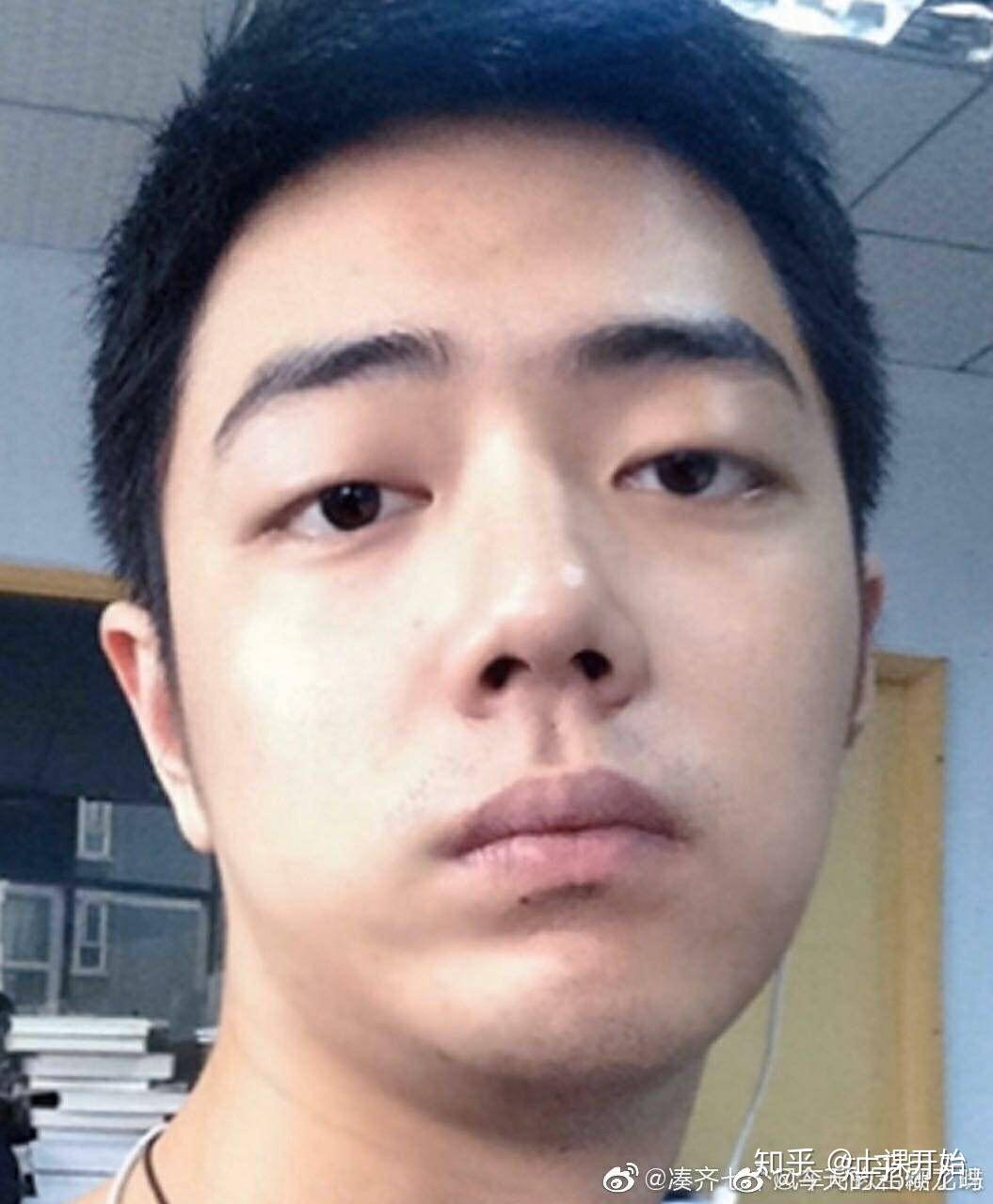 有没有肖战的丑照