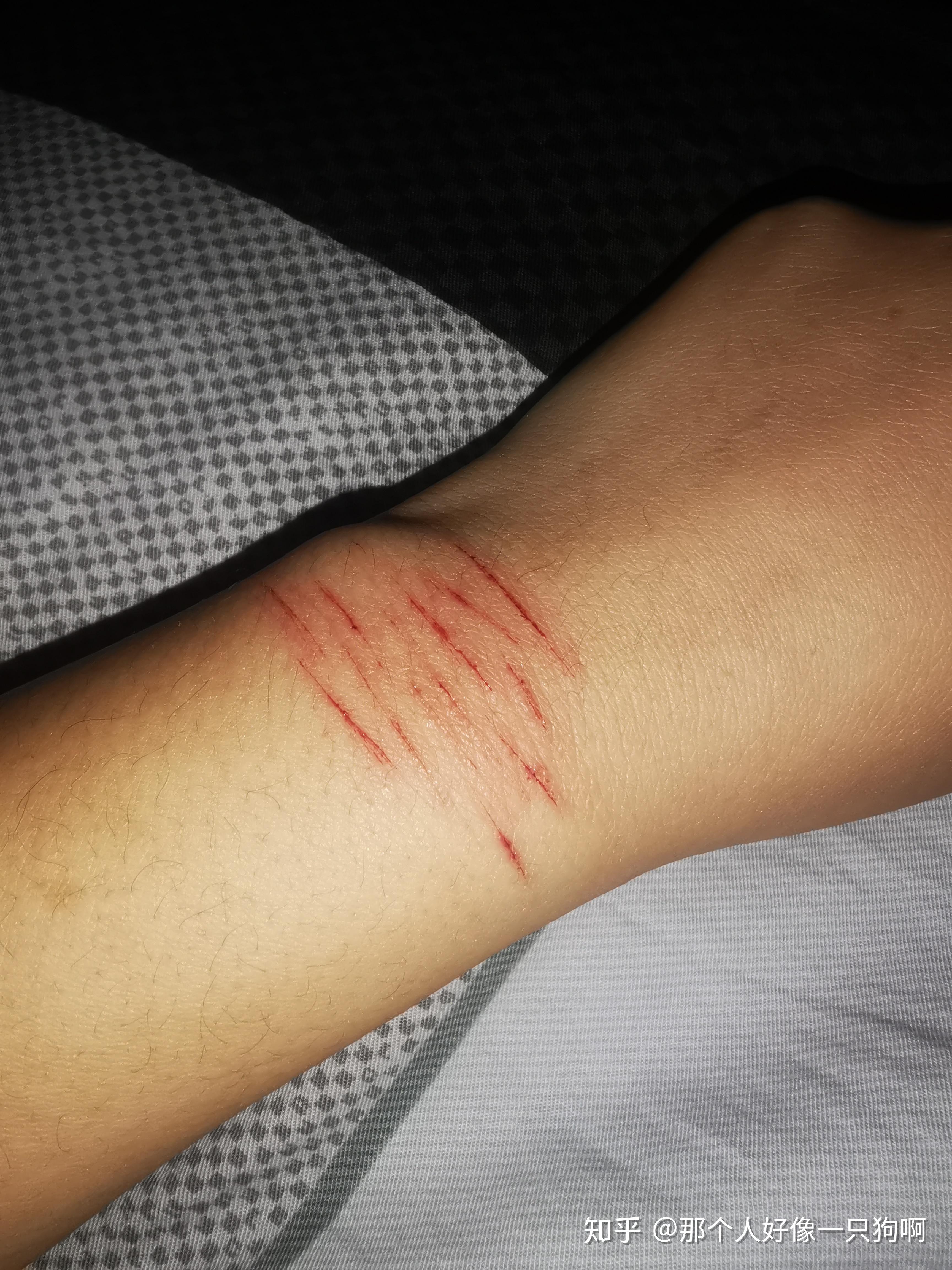 中度抑郁伴随躁郁症 可以自己自愈吗? - 知乎