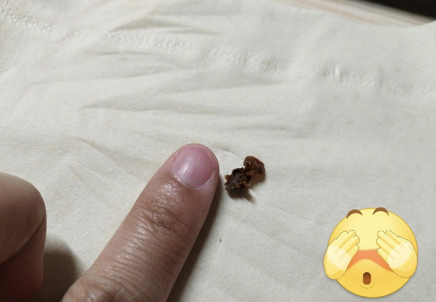 耳屎能大到什么程度? - 知乎