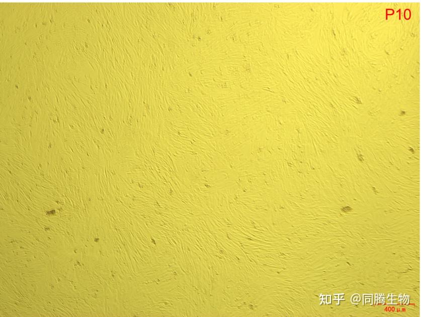 案例应用丨同腾新创msc培养基在间充质干细胞3d培养基中应用（上） 知乎 