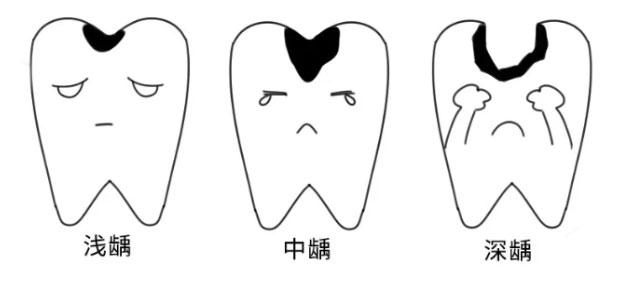 牙上有小洞怎么维持不发展?