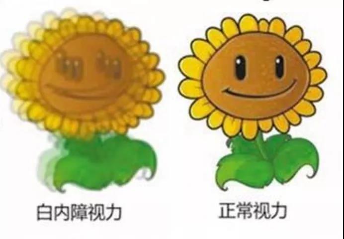 如何判断自己的白内障是在什么程度 该不该手术 白内障是怎么分期的 知乎 如何判断自己的白内障是在什么程度 该不该手术 白内障是怎么分期的 知乎