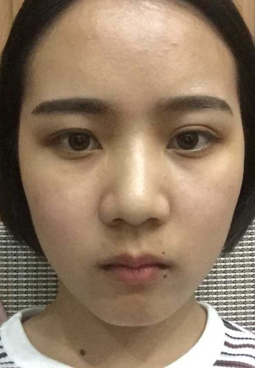 山根低鼻梁高是怎样的体验? - 知乎