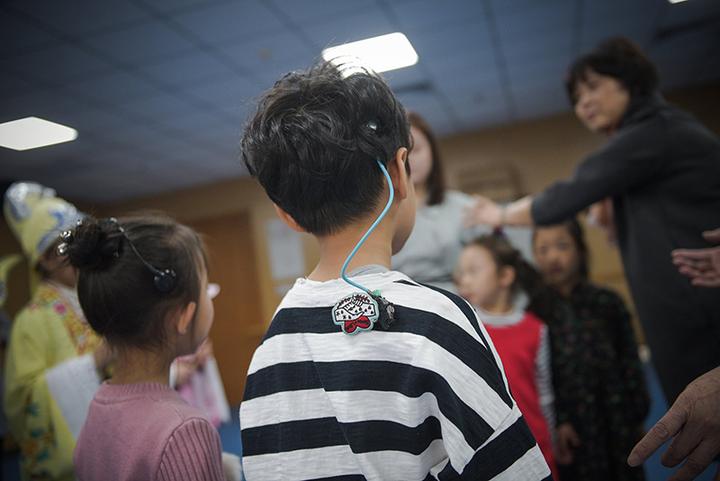 也许,2700万听障患者都可以重获新声 - 知乎