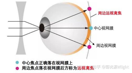 经常说周边离焦,你知道什么是周边离焦嘛? - 知乎