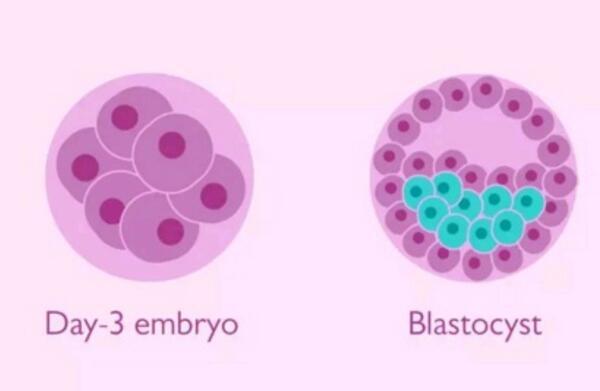 水瓶座的爱情观在不同年龄段有何变化 v2-1bc6f12d4c94cc59a3db32145102d97d_1440w.jpg?source=172ae18b