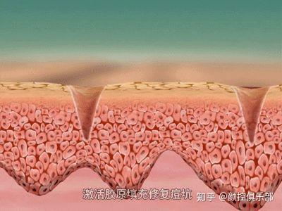 点阵