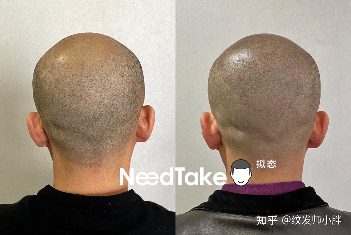 认真听讲！纹发需要多长时间？ - 知乎