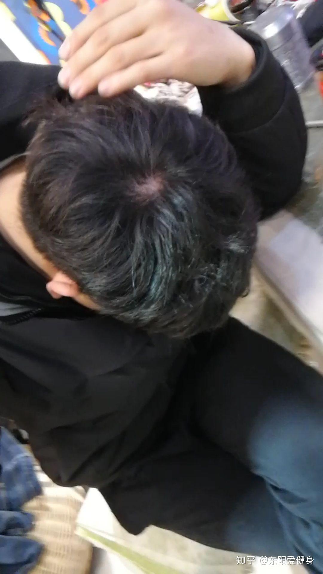 头顶旋的地方这个发量正常吗? - 知乎