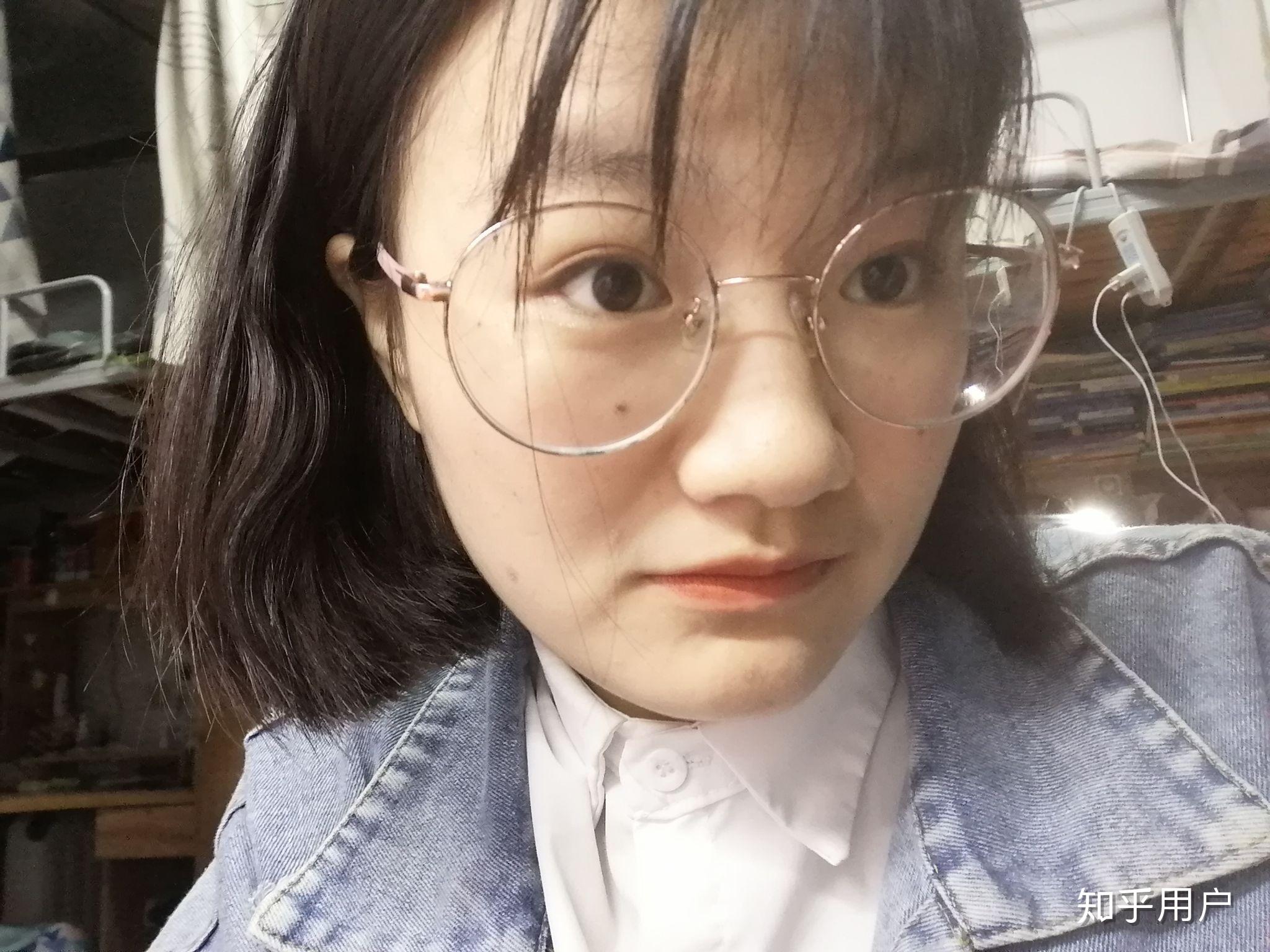 月亮脸,面中凹陷,下巴突出,很丑很自卑,请问正颌手术能改变我的脸型吗