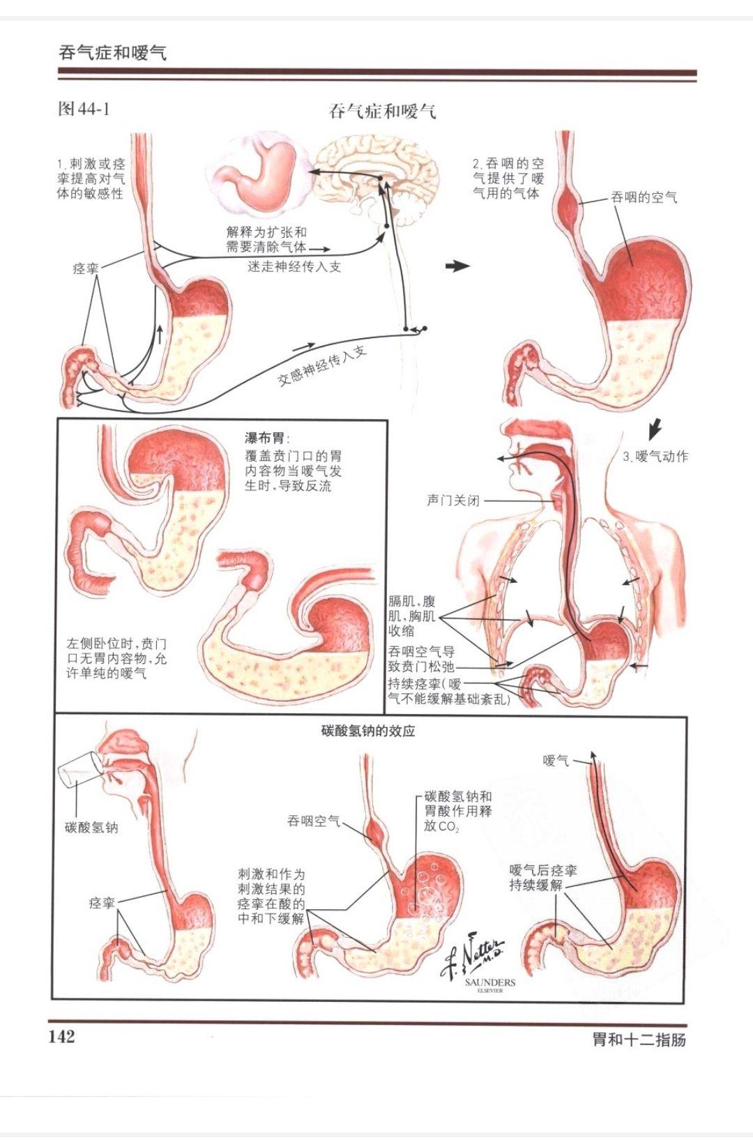 功能性胃肠病—癔症球 - 知乎