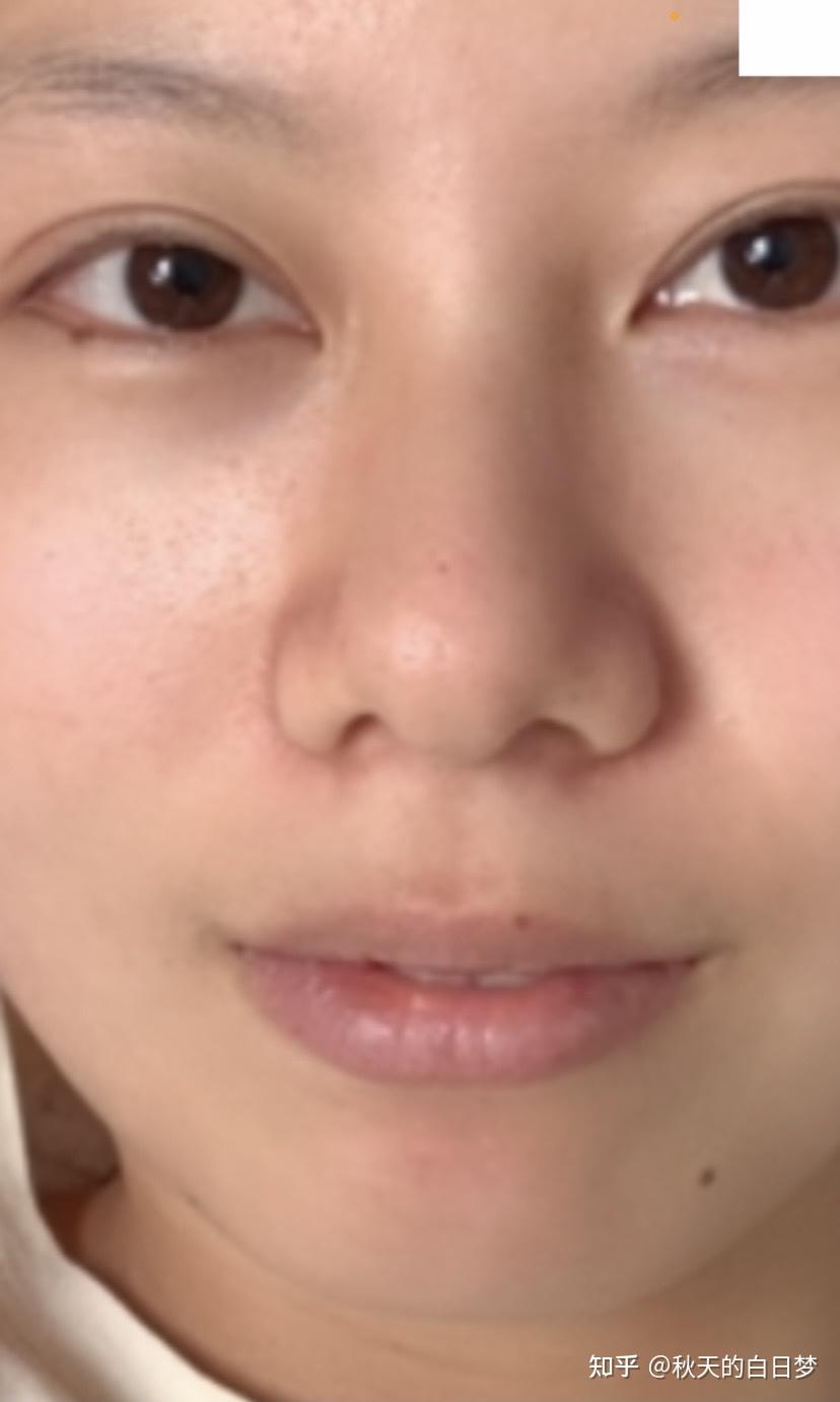 有没有鼻头大鼻翼宽但是鼻子很挺的人