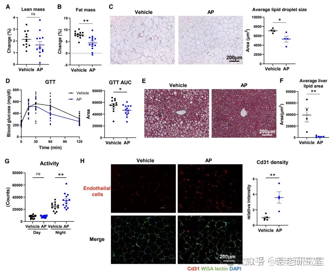 Cell Metabolism: 清除衰老的血管细胞能够改善肥胖代谢! - 知乎