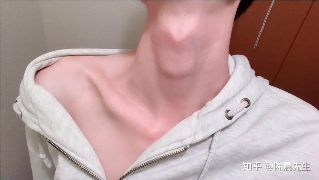 请问为什么男生的喉结不能乱摸呢? - 知乎