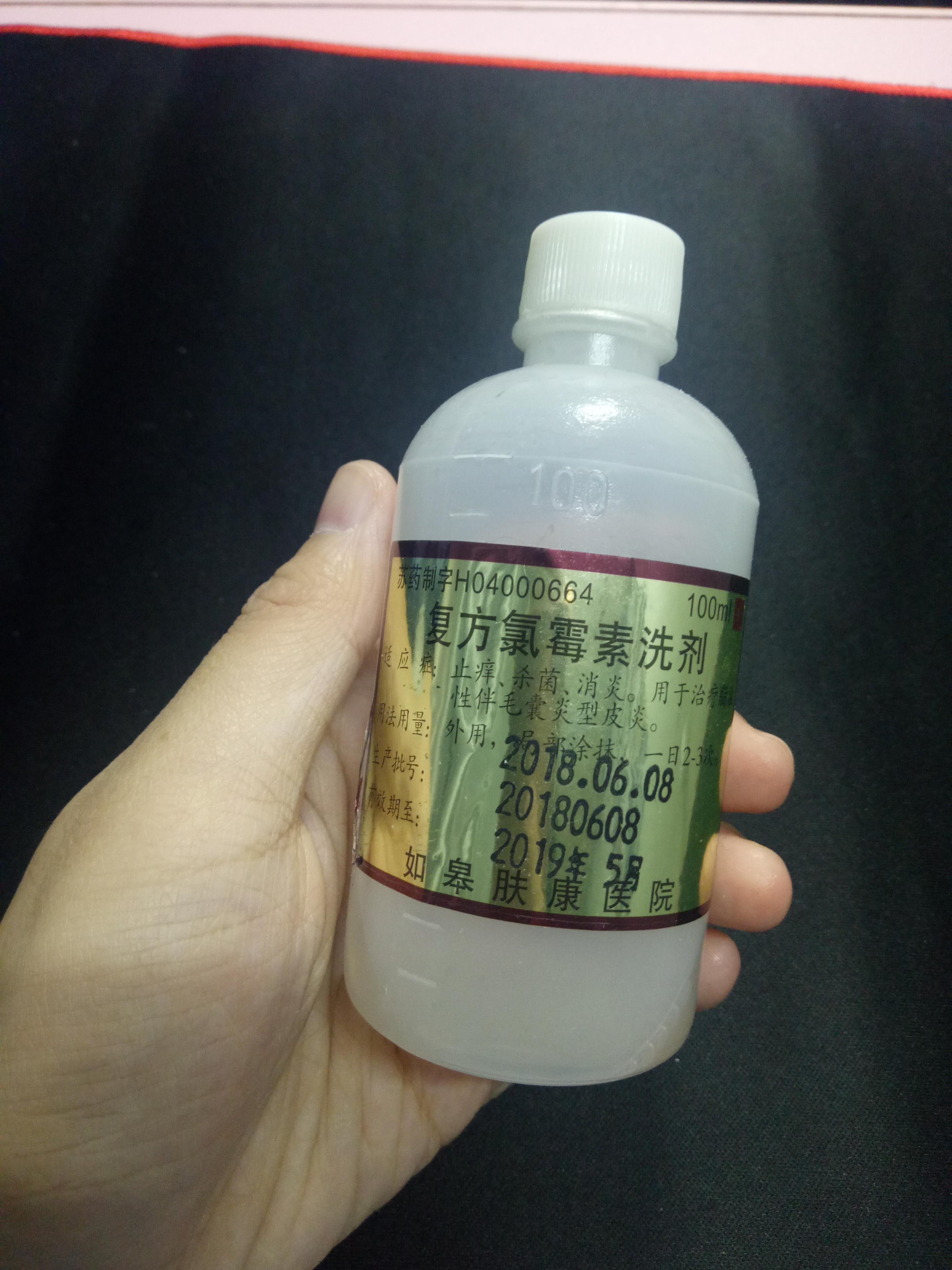 脂溢性皮炎为什么头皮上耳朵里都出现白屑