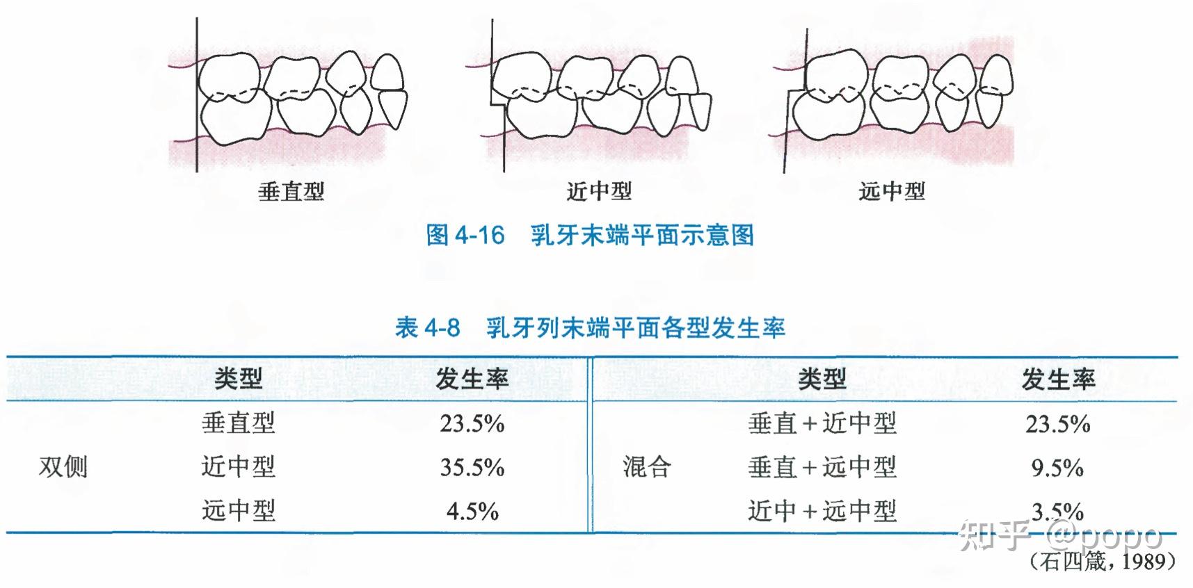 侧方牙群替换顺序对牙列的影响 - 知乎