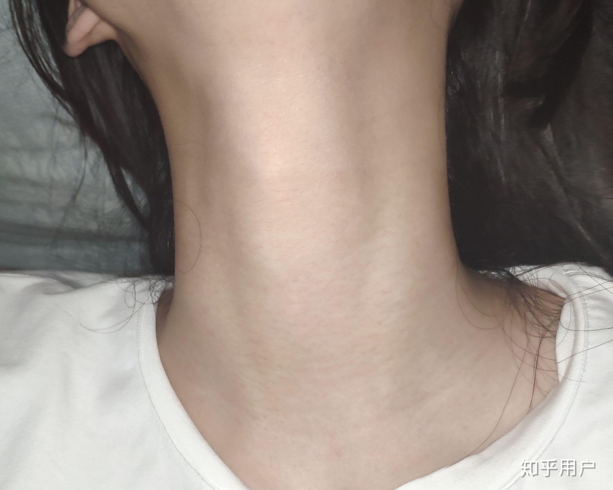 女生的脖子 喉结图片