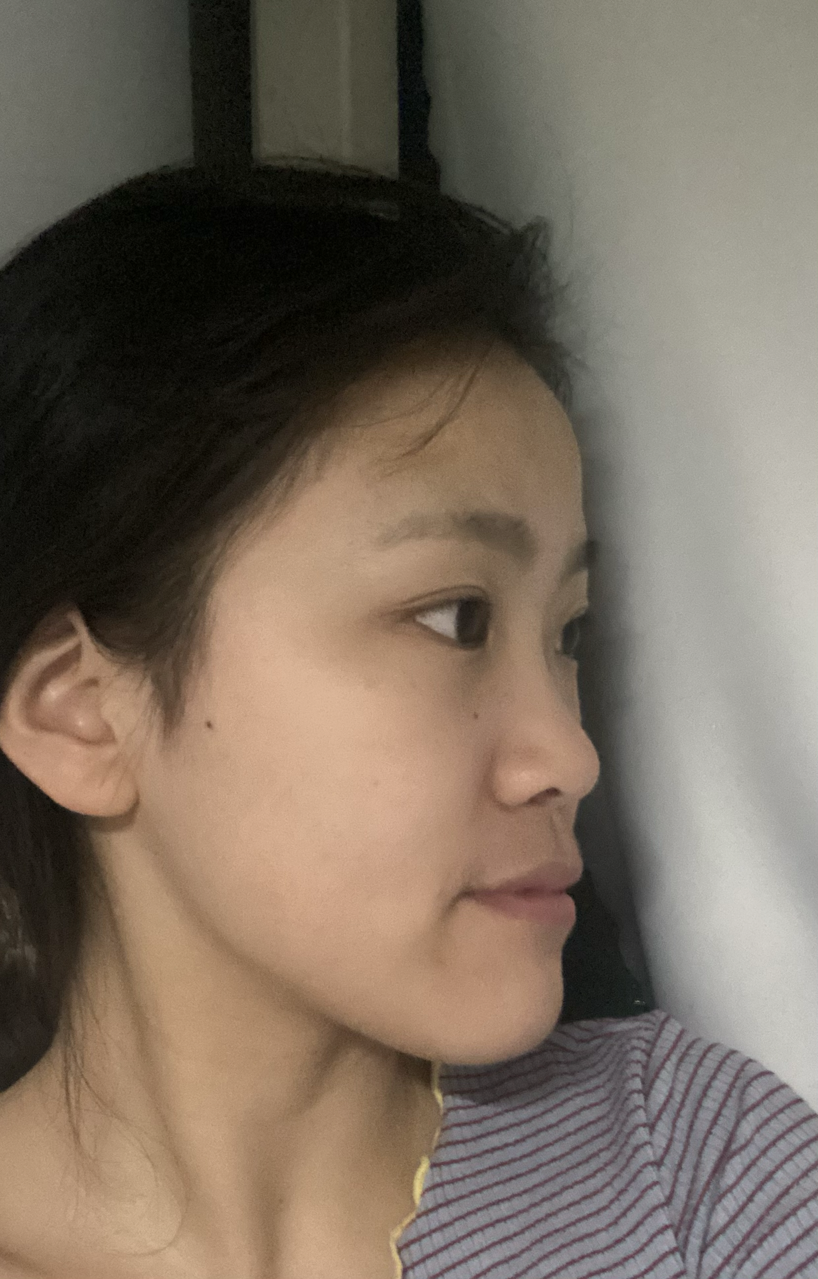 下巴前突,但并不是地包天,很自卑,怎么办? - 知乎