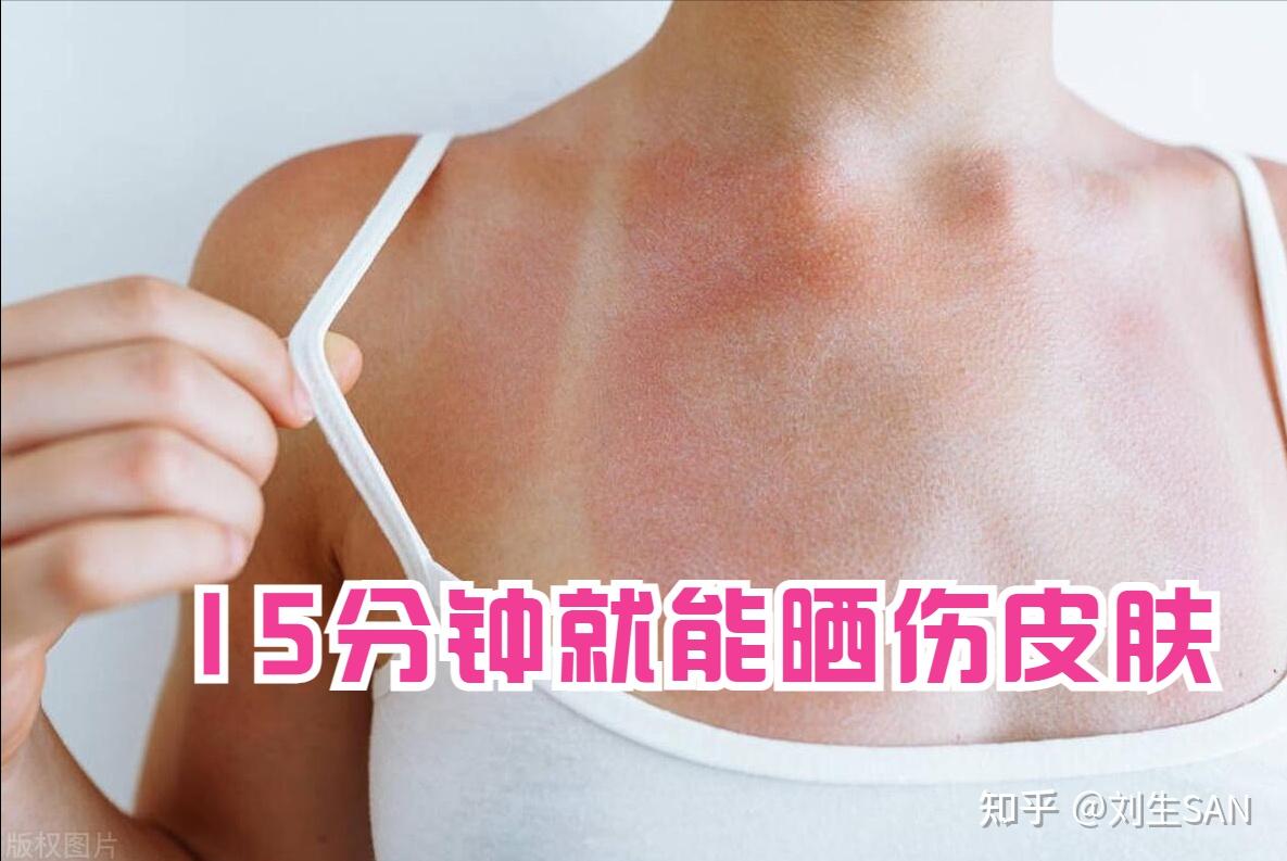 15分钟暴晒致癌！扑脸大苍蝇，美移澳博主揭露两国文化差异- 知乎