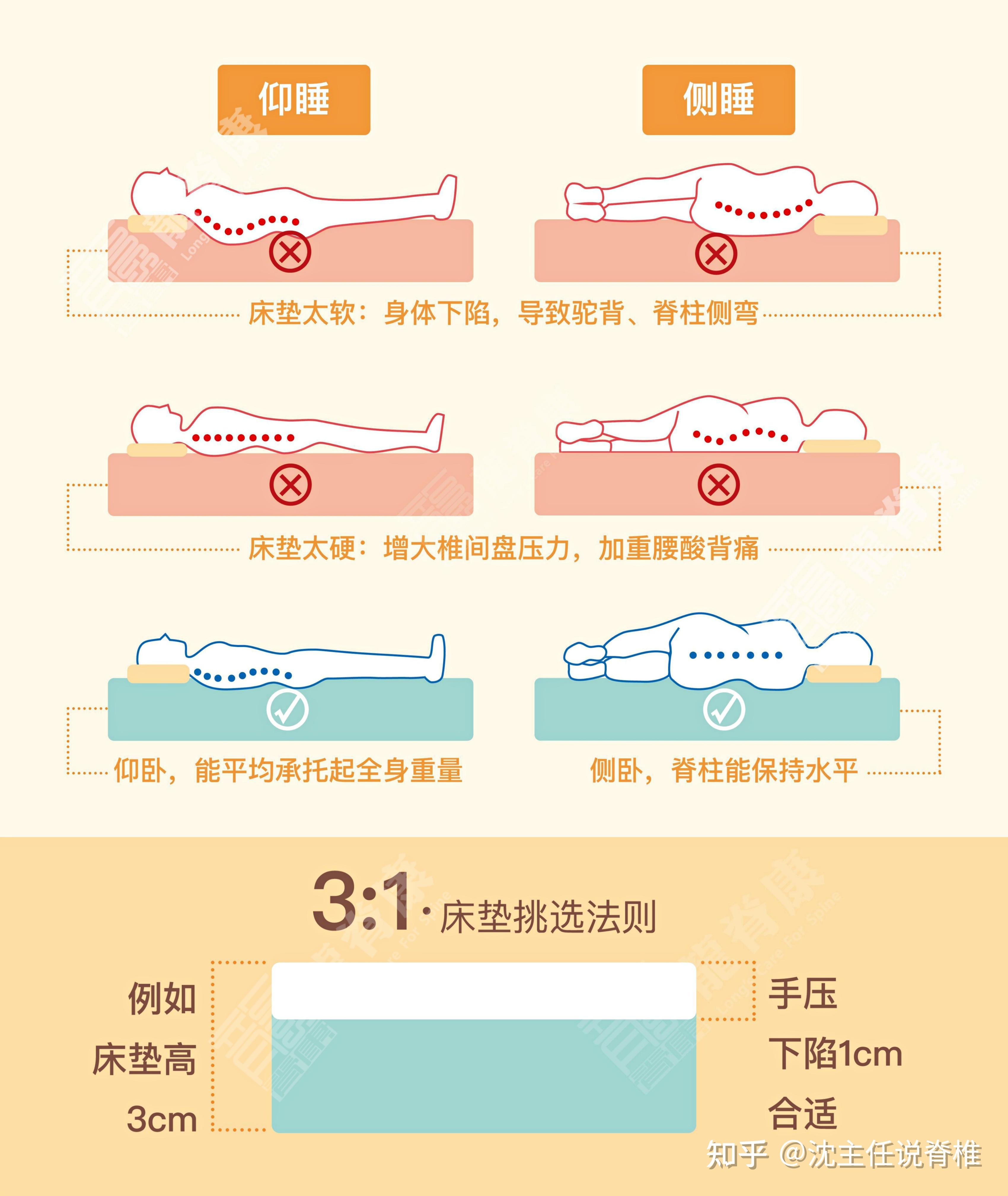 腰椎间盘突出睡什么床垫比较好? - 知乎