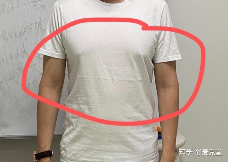 男生胸部雌化怎么改善? - 知乎