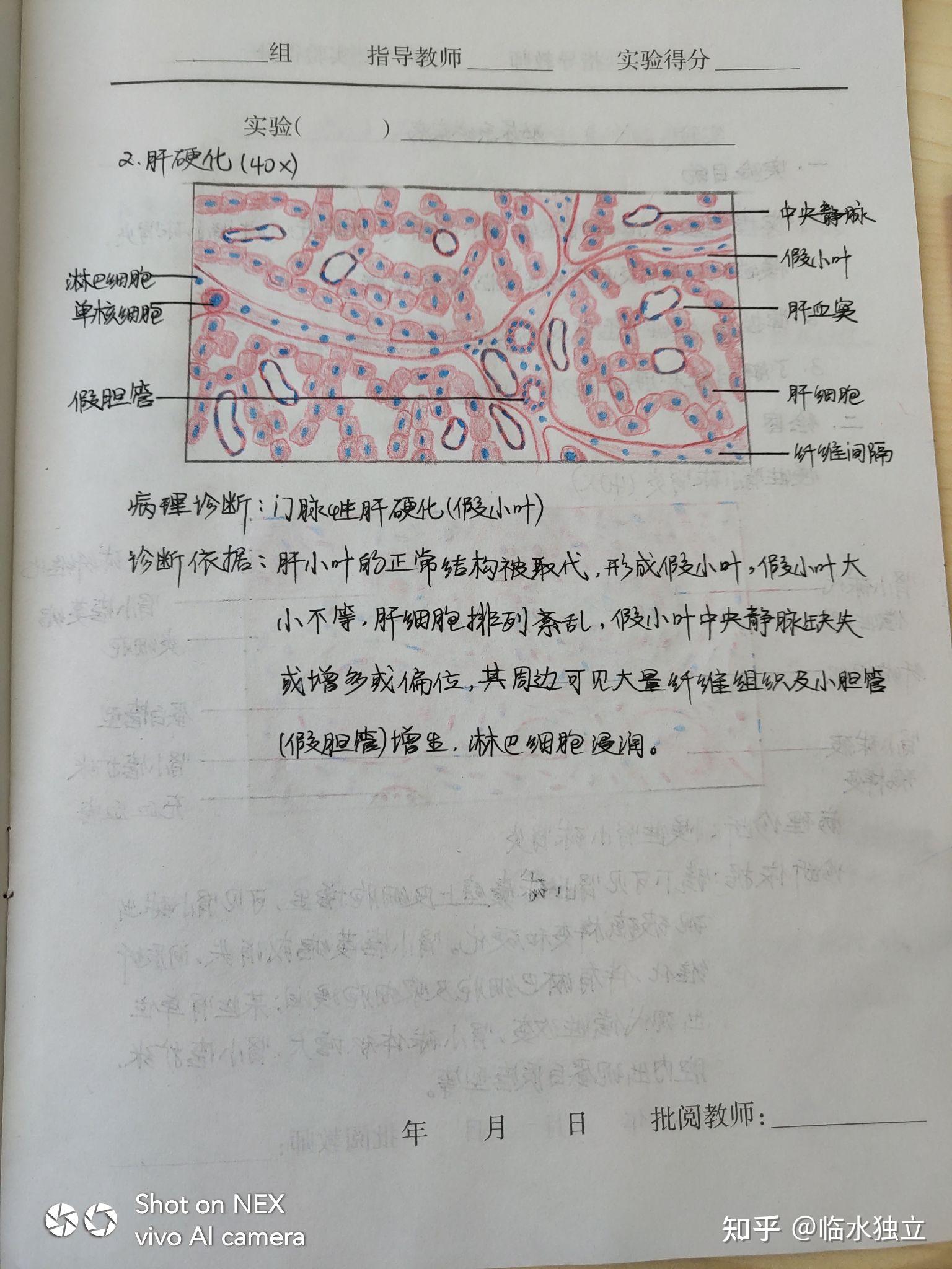 甲状腺红蓝铅笔绘图图片