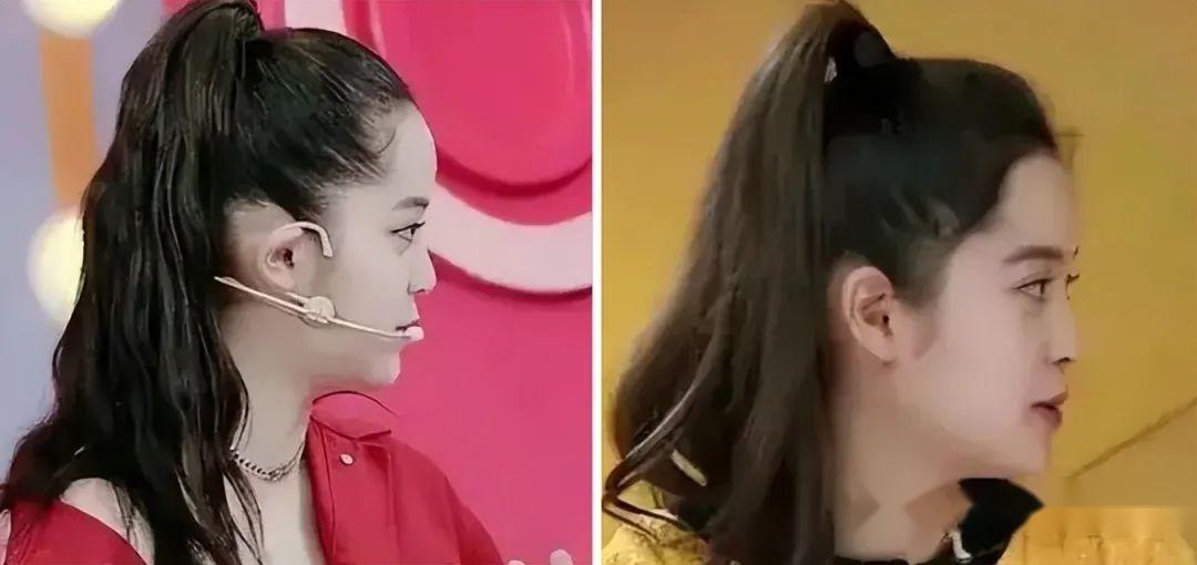 “扁平脸”有多影响颜值,80%亚洲人都有的颜值短板,要如何逆袭 - 知乎