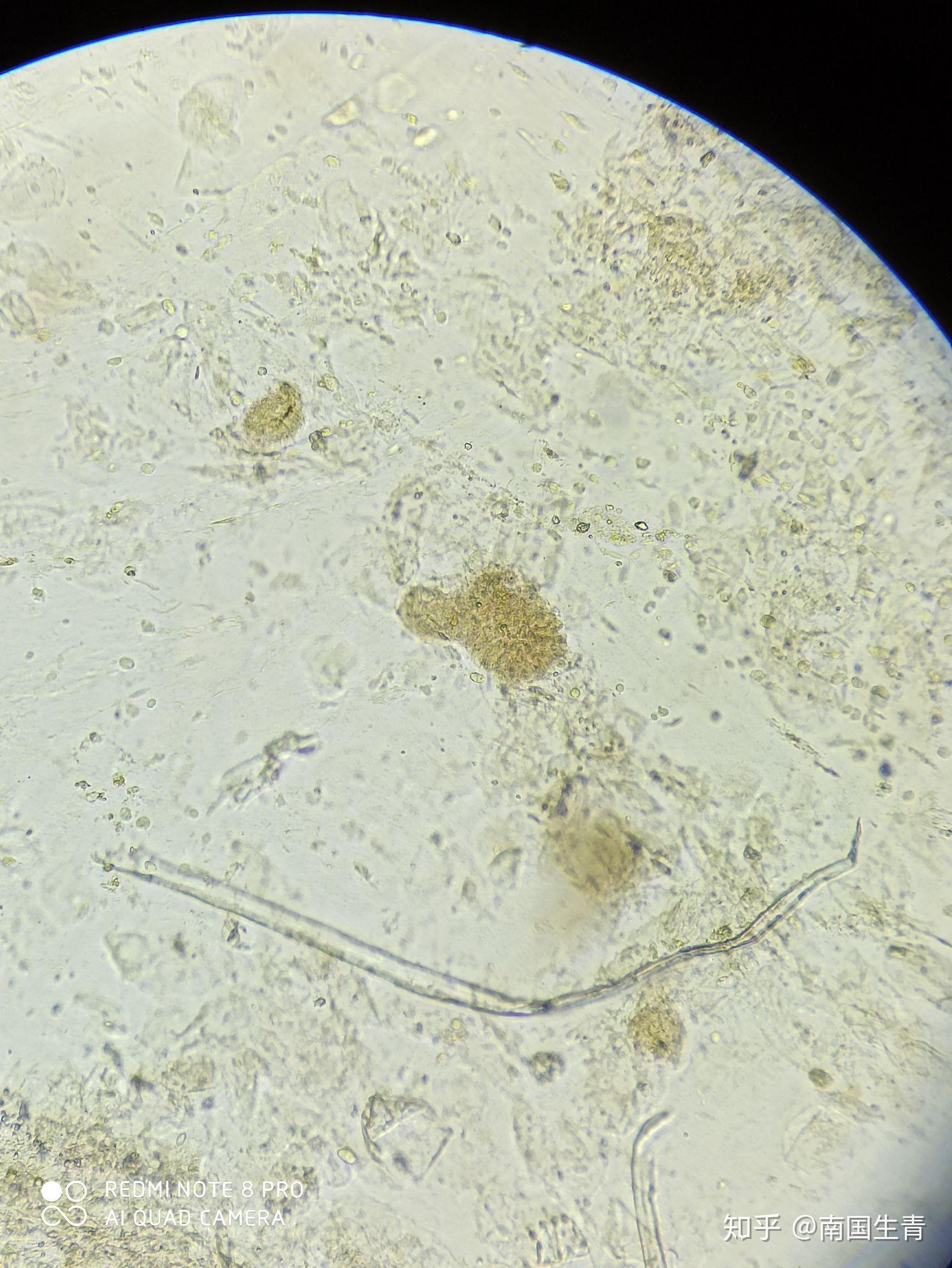 (显微镜图片与视频)请问这里面有寄生虫或者虫卵吗? 