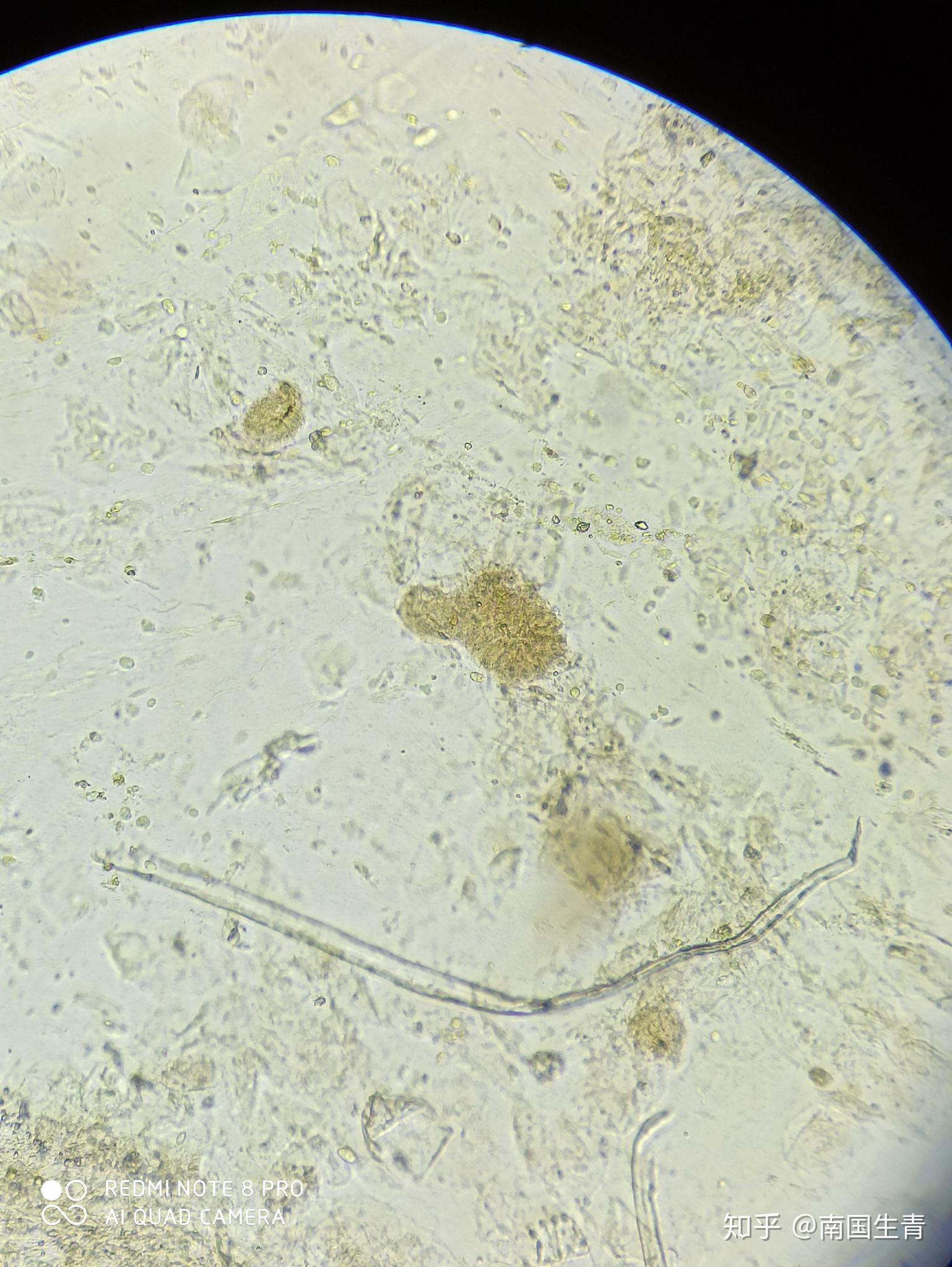 (显微镜图片与视频)请问这里面有寄生虫或者虫卵吗? - 知乎