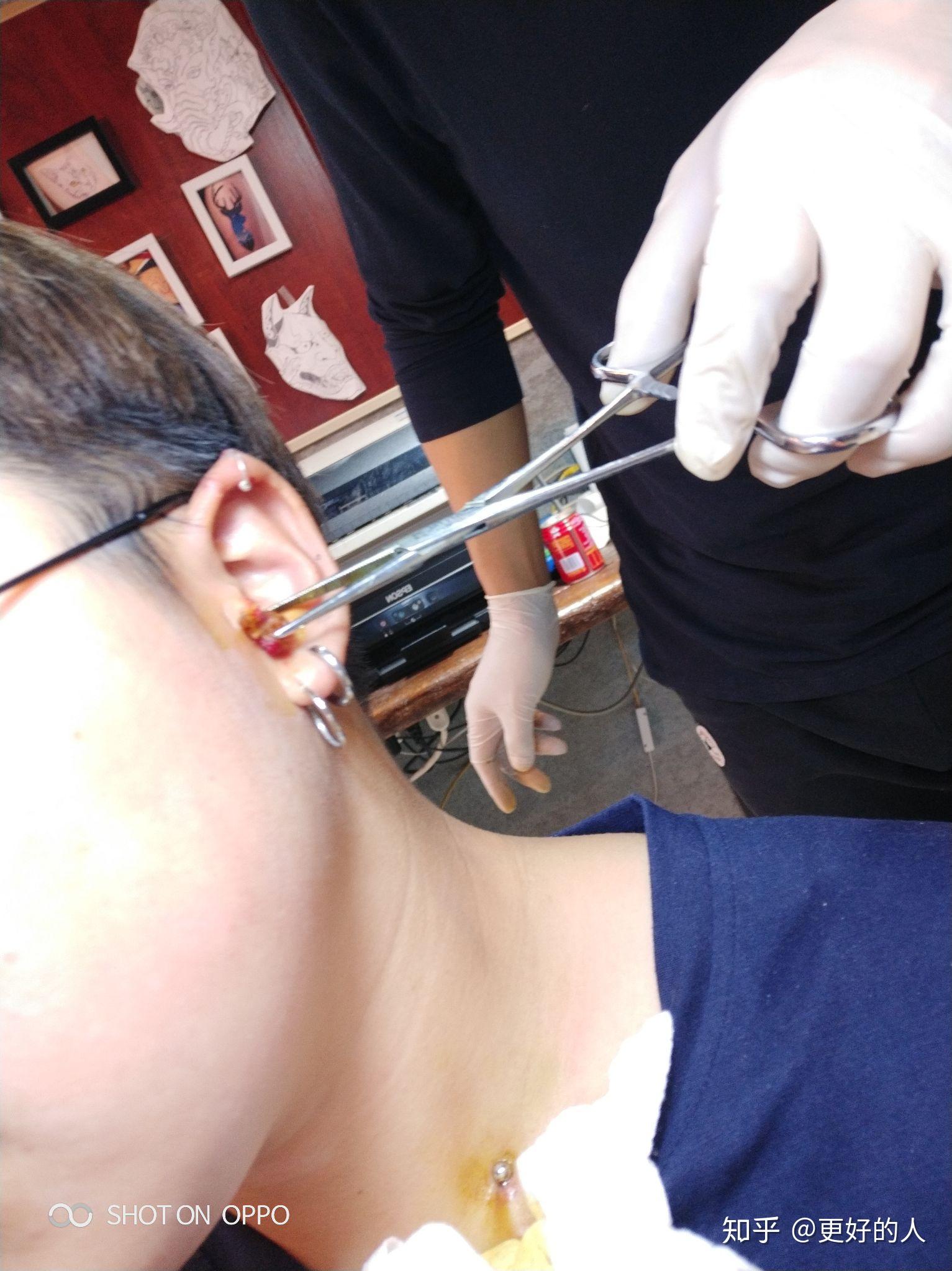 手穿耳洞的具体过程