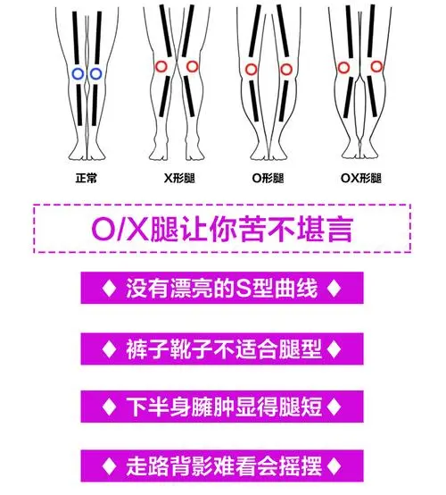 只是腿型不好看？x型腿的痛你不懂 知乎