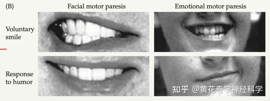 情绪脑科学：为什么人会有情绪？如何看脸识人？ - 知乎