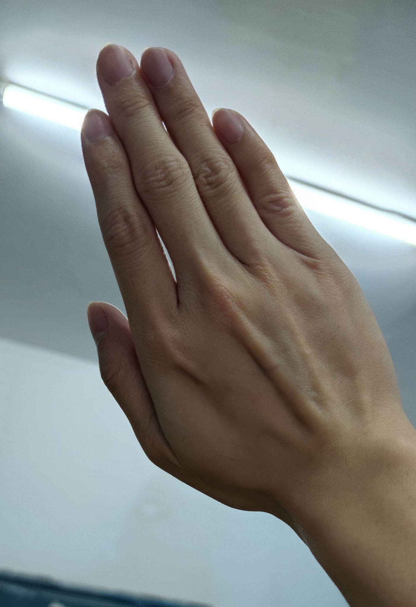 为什么小拇指是弯的