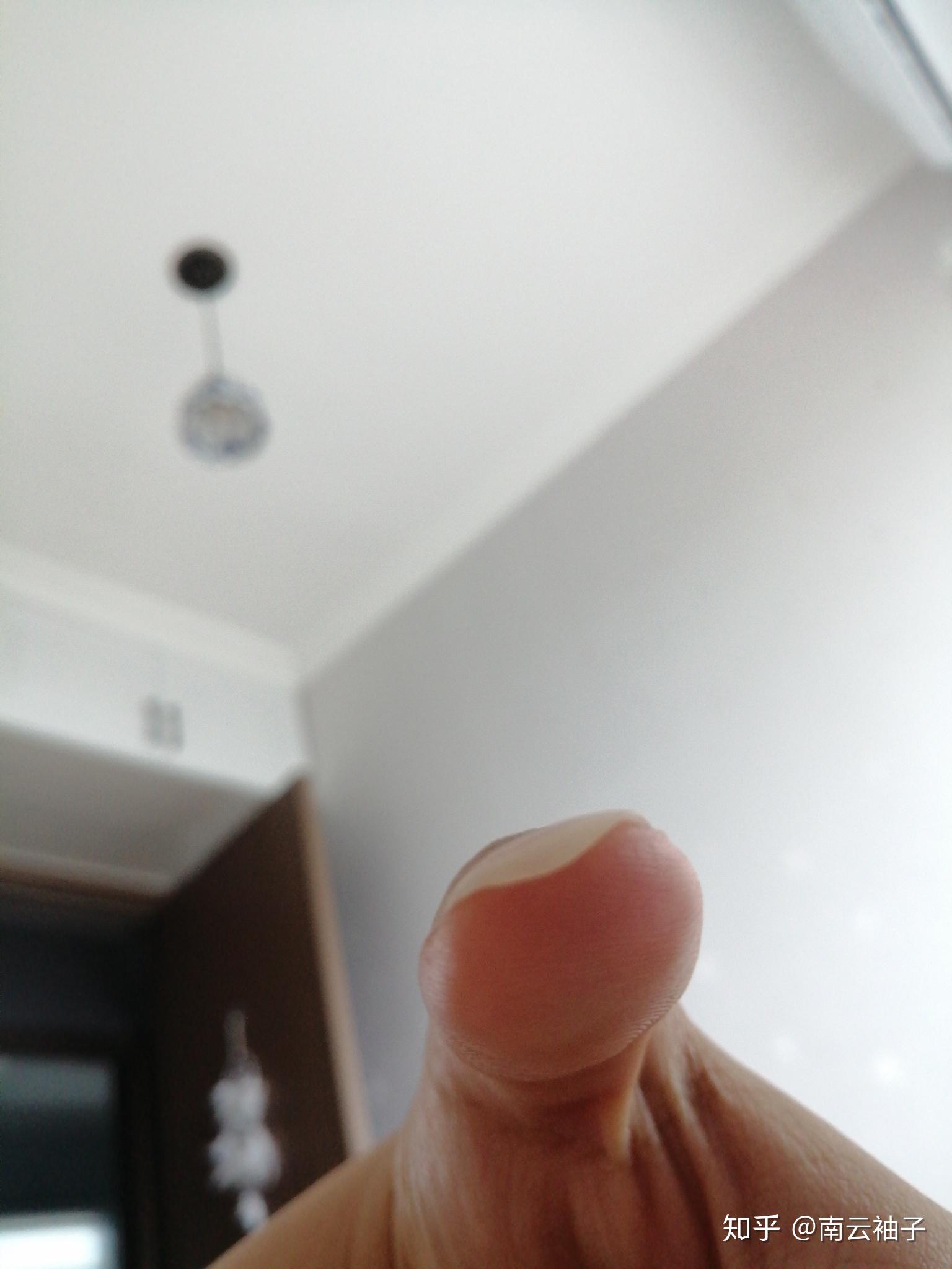 指甲长出的一半向下弯曲是什么情况