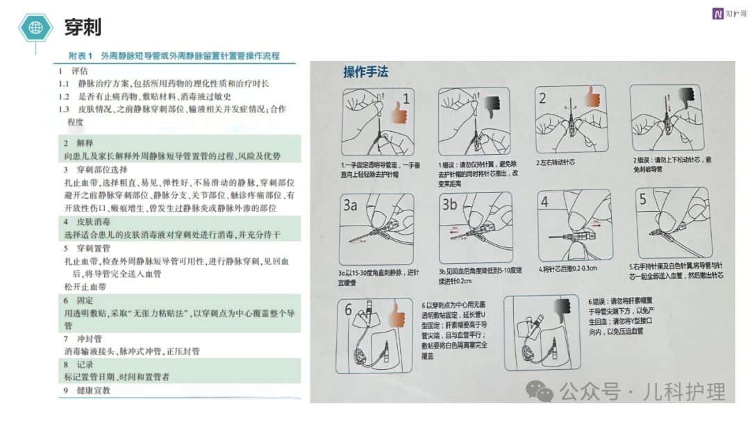 儿科静脉留置针的应用及护理