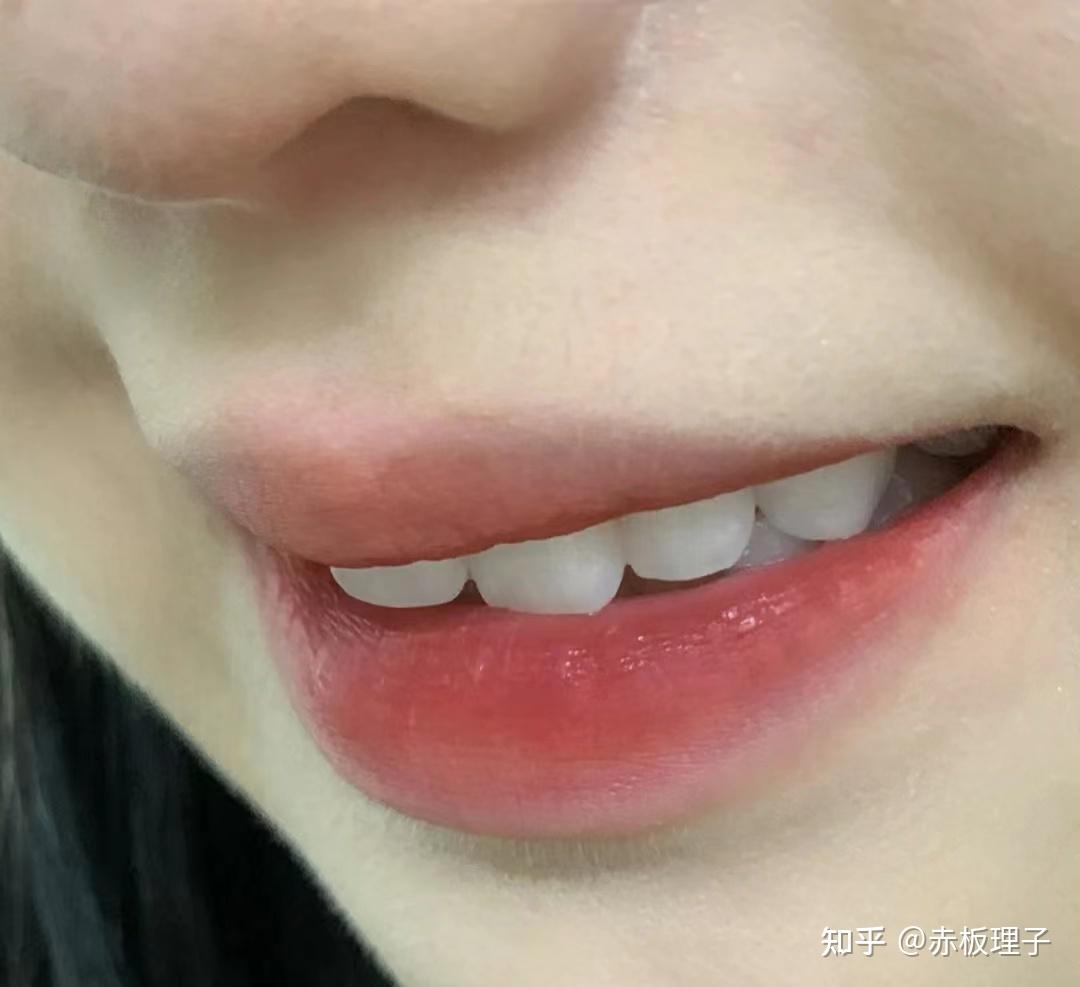 怎么才能让皮肤又白又干净 v2-213c8eea94481544203450e81fac23d4_r.jpg