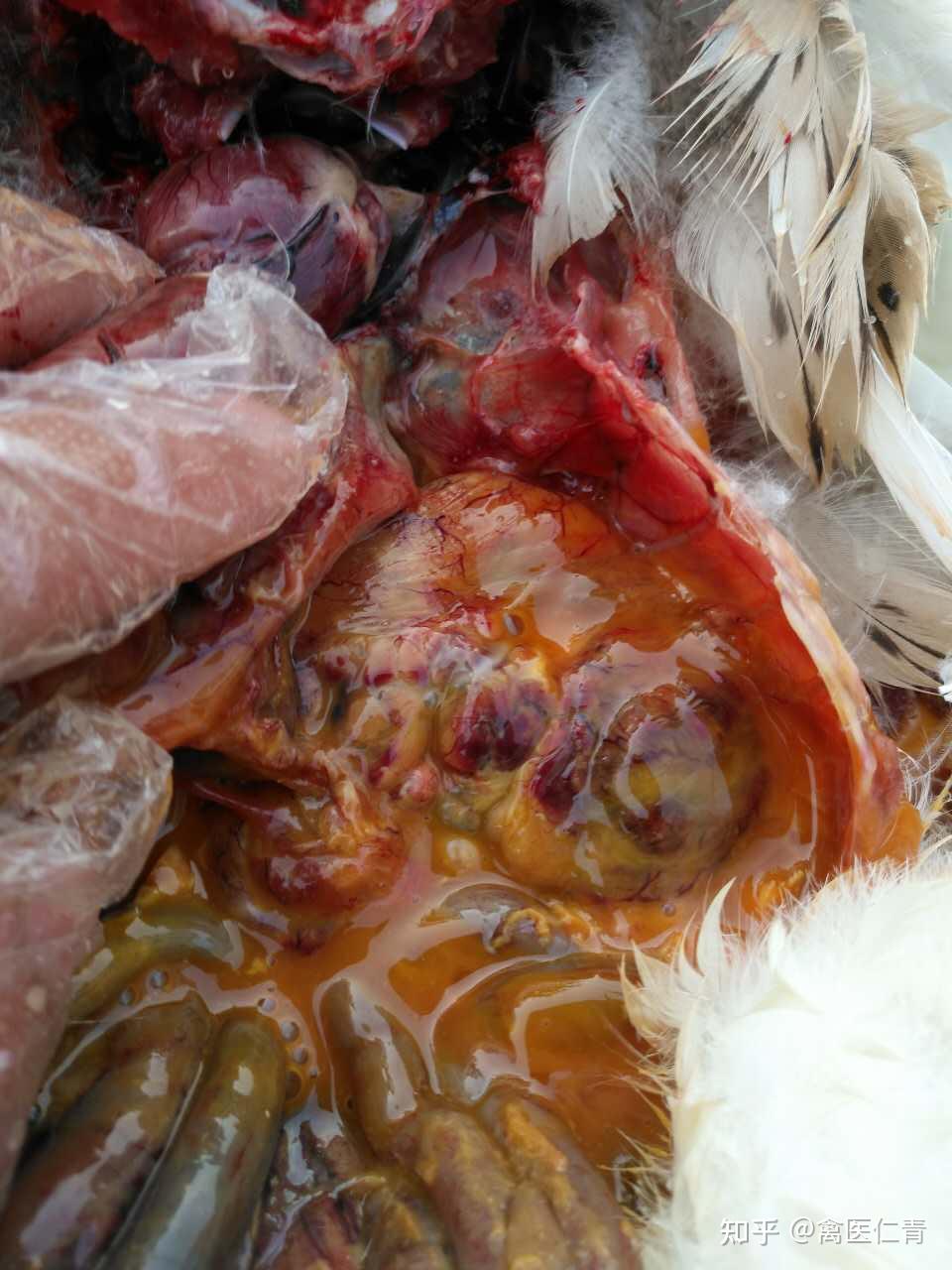 鹅卵黄性腹膜炎详解大全