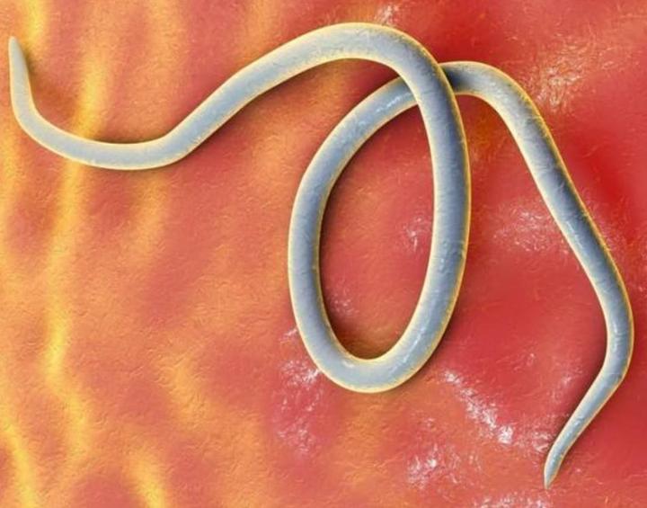 蛲虫病感染的并发症及相关疾病