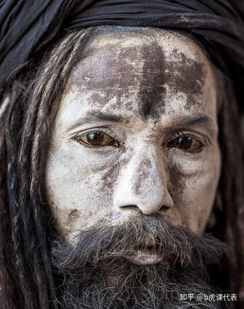 为什么食人族里面不会爆发朊病毒